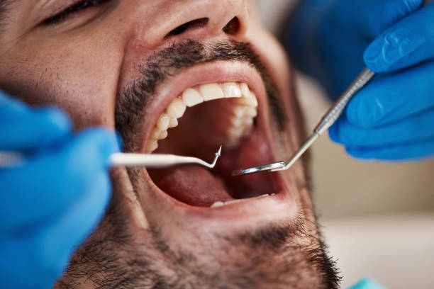 Best Emergency Gum Treatment in Everett, WA